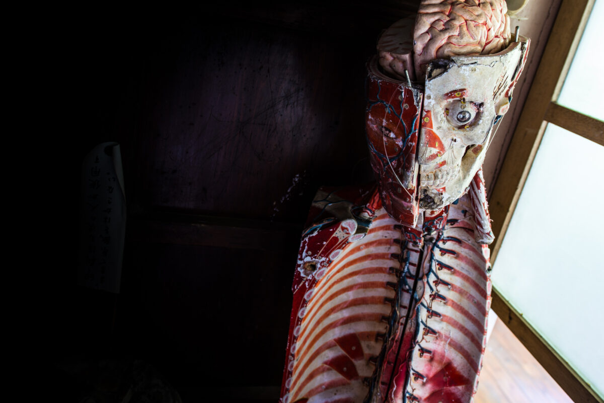 Life-size anatomical mannequin by window showing exposed muscles, skull, and brain model